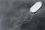 腸管出血性大腸菌O157の写真