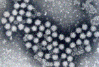 SRSV菌の写真